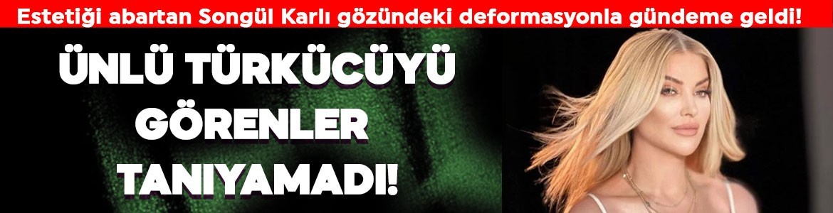 Songül Karlı'yı görenler tanıyamıyor! Son olarak gözündeki deformasyonla gündeme geldi