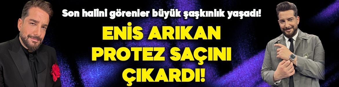 Enis Arıkan protez saçını çıkardı! Son halini görenler büyük şaşkınlık yaşadı!