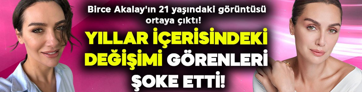 Birce Akalay'ın 21 yaşındaki görüntüsü ortaya çıktı! Yıllar içerisindeki değişimi görenleri şok etti