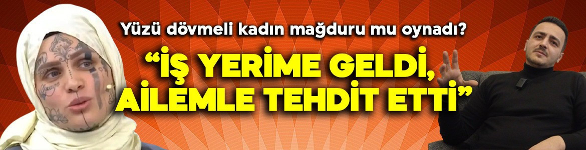 Yüzü dövmeli kadın mağduru mu oynadı? İddialara yanıt gecikmedi: İş yerime geldi, ailemle tehdit etti