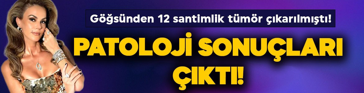 Göğsünde kitle tespit edilmişti! Ameliyat olan Tülin Şahin'in patoloji sonuçları çıktı