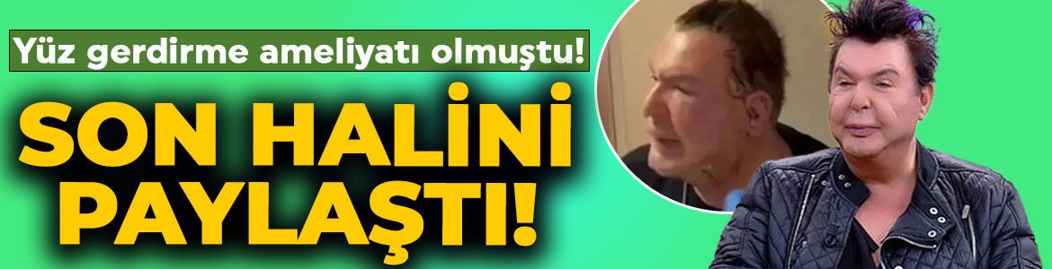Yüz gerdirme operasyonu geçirmişti! Kuşum Aydın son halini paylaştı