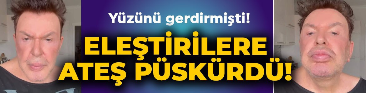 Yüz gerdirme operasyonu geçiren Kuşum Aydın eleştirilere ateş püskürdü: Utanmasalar küfür edecekler!
