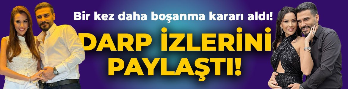 Dilan Polat bir kez daha boşanma kararı aldı! Darp izlerini paylaşıp sildi