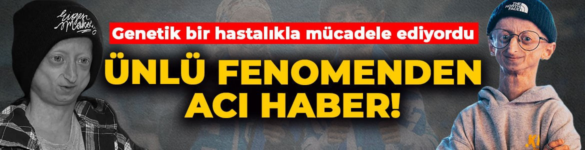 Genetik bir hastalıkla mücadele ediyordu! Ünlü fenomen Michiel Vandeweert hayatını kaybetti