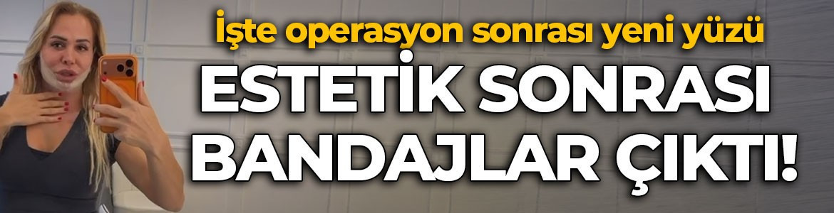 Nagihan Karadere bandajları çıkardı! İşte son hali