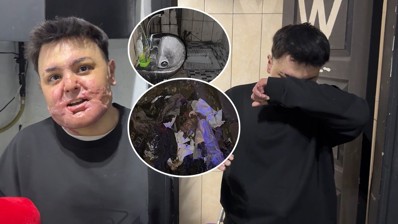 15 yaşındaki çocuğun hayatı saniyeler içinde kabusa döndü! 65 ameliyat geçirdi, 12 gün uyutuldu! 'Mücadeleyi bırakmadım'