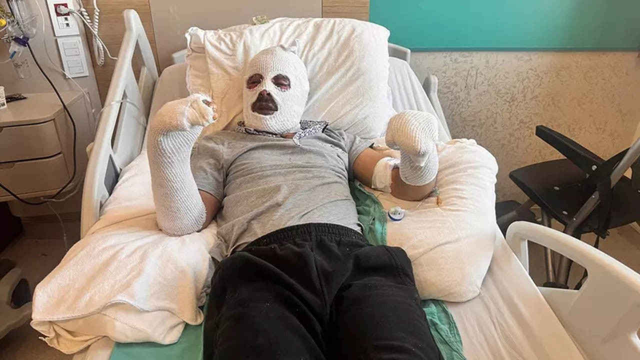 Çay demlemek isterken kabusu yaşadı!