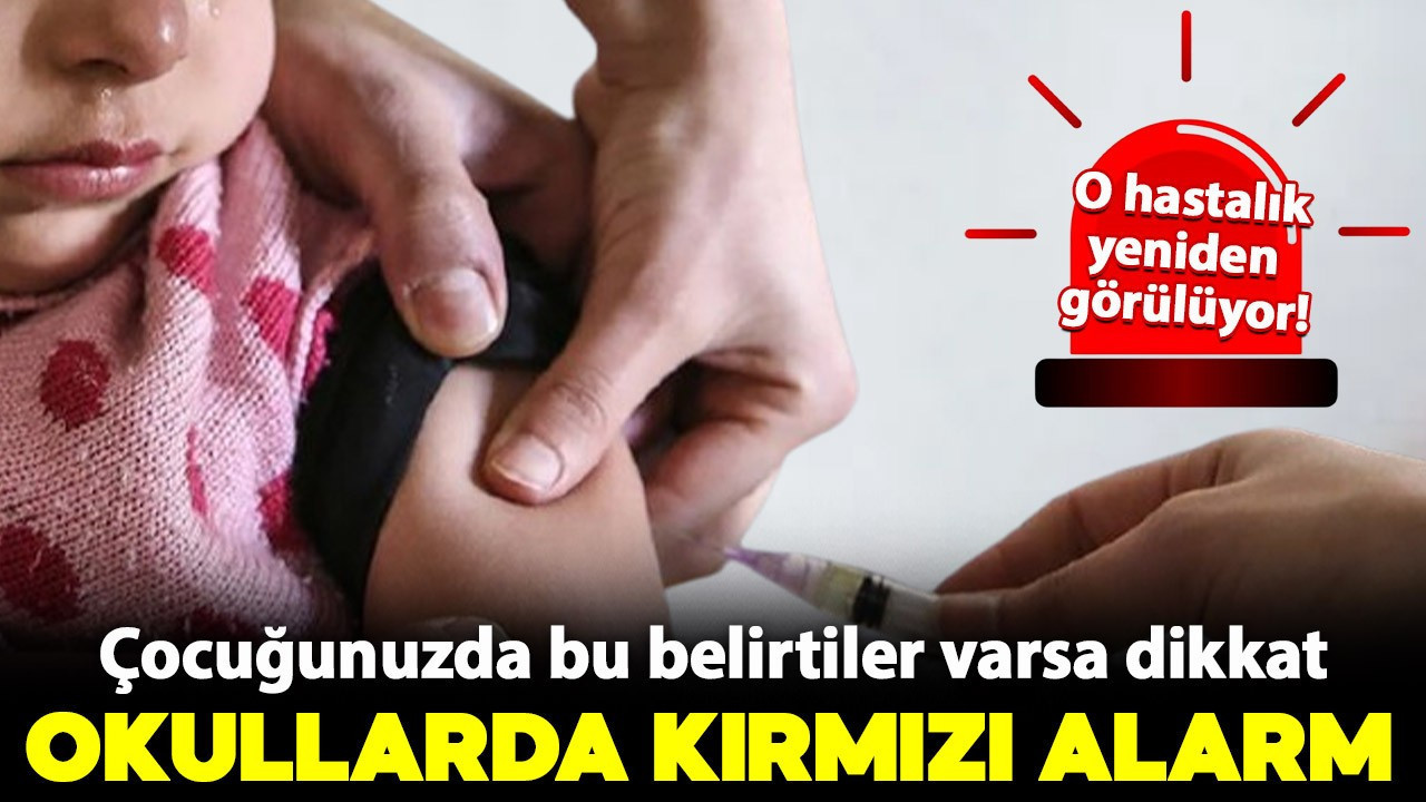 Okullarda kırmızı alarm! Çocuğunuzda bu belirtiler varsa dikkat: O hastalıkta dikkat çeken artış yaşanıyor