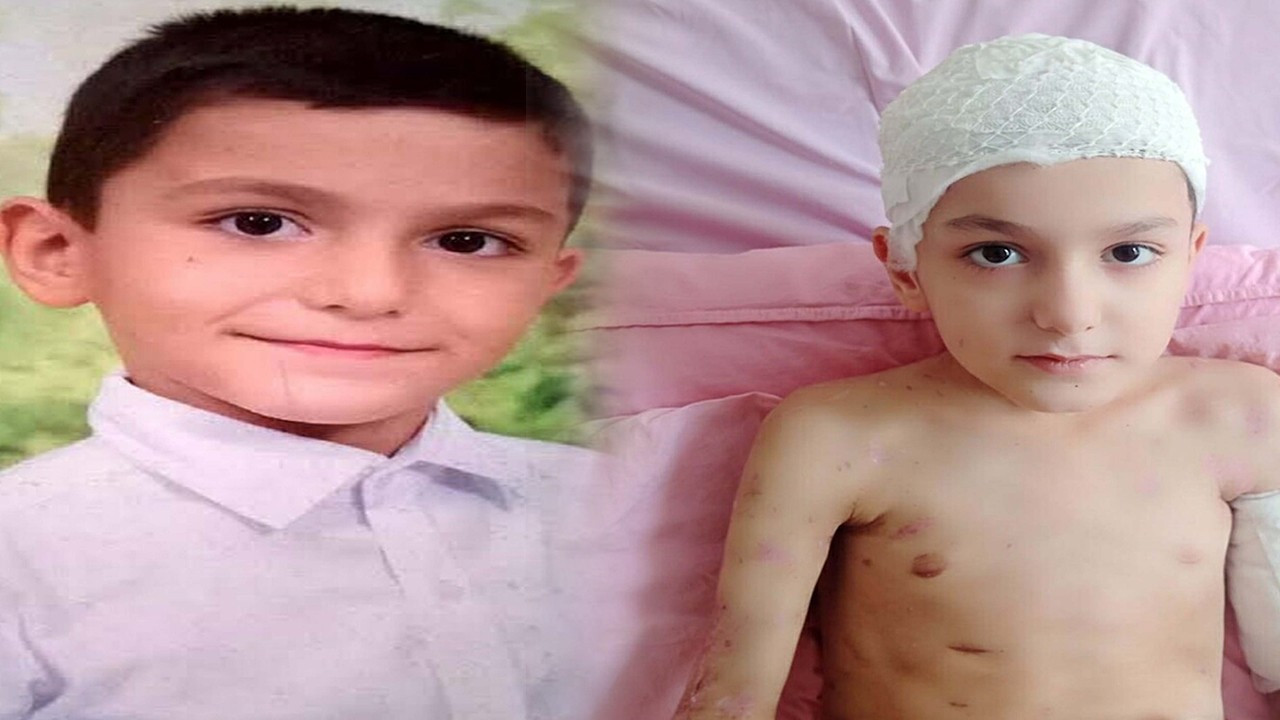 Köpeklerin saldırısına uğrayan Tunahan 15 kez ameliyat olmuştu! 'Şu ana kadar görülmemiş karar'