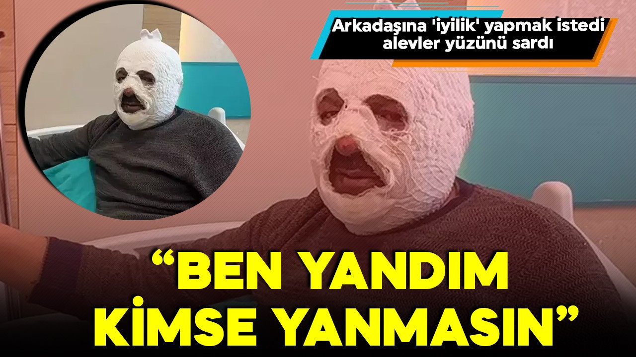 Arkadaşına 'iyilik' yapmak istedi, alevler yüzünü sardı: Ben yandım kimse yanmasın!