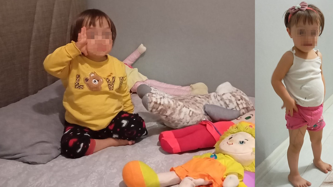 'Down sendromlu bebek' davası! Özel hastane 700 bin lira ödemeyi reddetti! 77 milyon lira tazminat ödeyecek