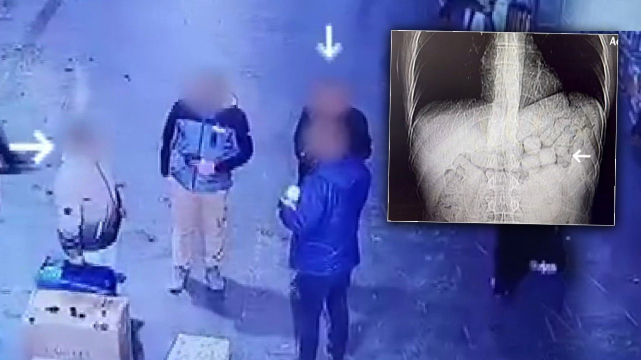 Diyarbakır’da akılalmaz olay! Mide ve bağırsaklarından çıkanlar şoke etti