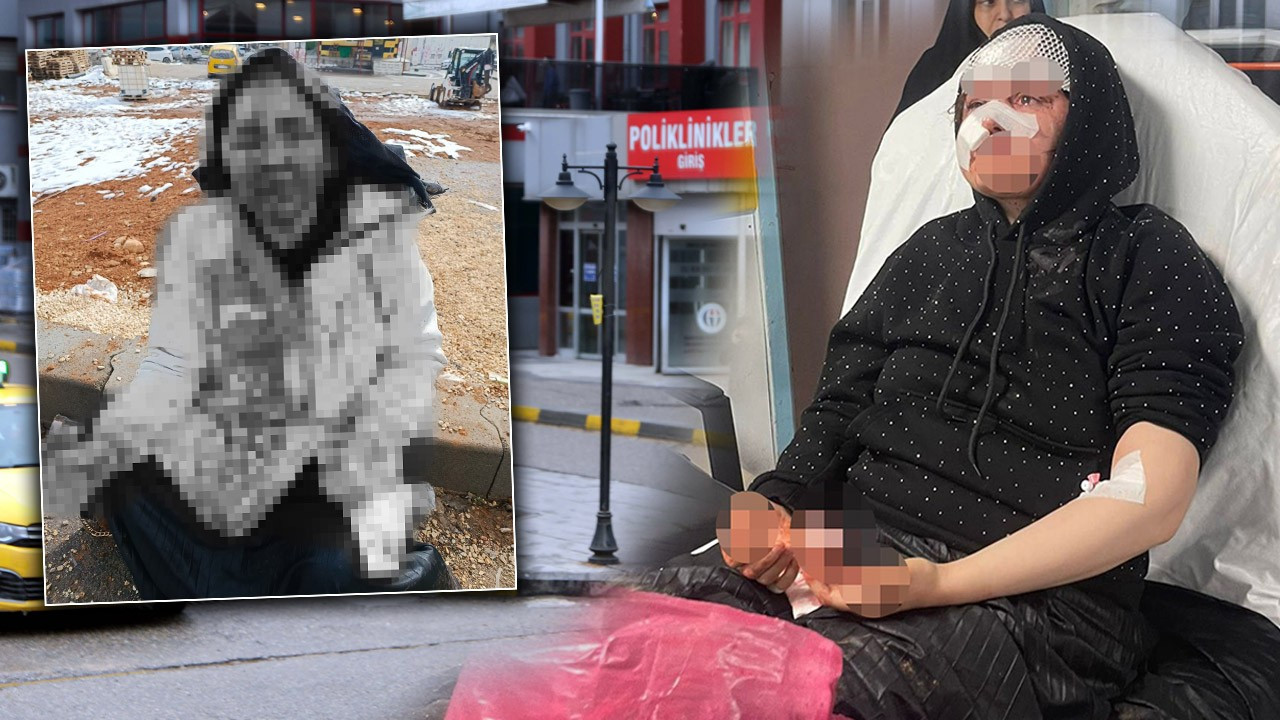 Boşanma aşamasındaki eşine dehşeti yaşattı! Sokak ortasında kaldırım taşıyla komaya soktu!