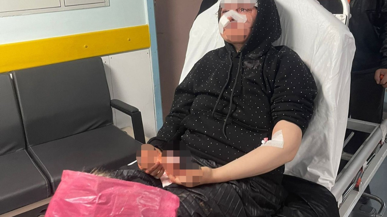 Gaziantep'te dehşet! Boşanmak isteyen eşini öldüresiye darp etti