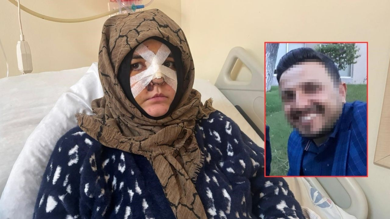 Sokak ortasında öldüresiye darp etti! Eş dehşet anlarını anlattı: Taşla suratıma defalarca vurdu