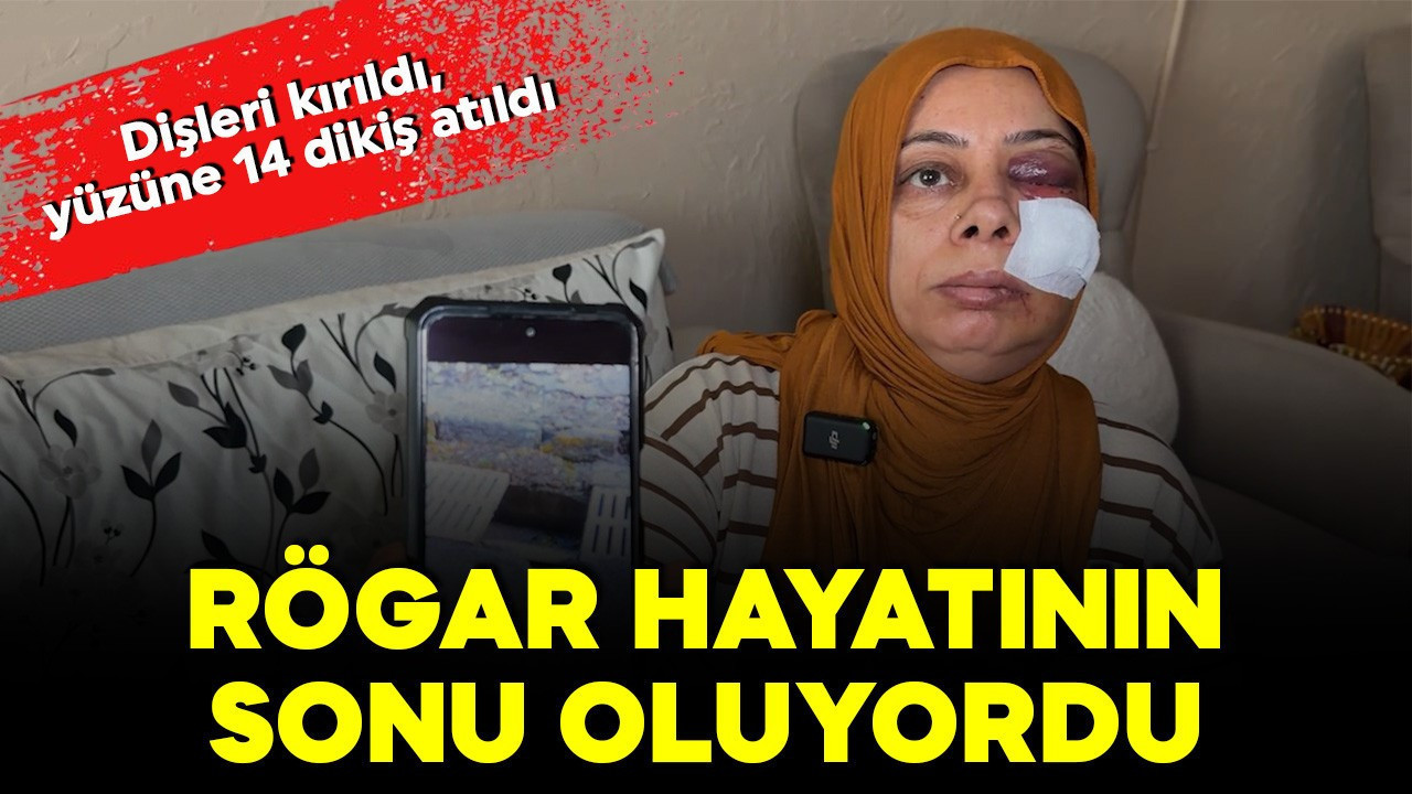 Kapağı kırık rögar dehşeti: Elektrikli bisikletli kadın ölümden döndü! Onlarca dikiş atıldı