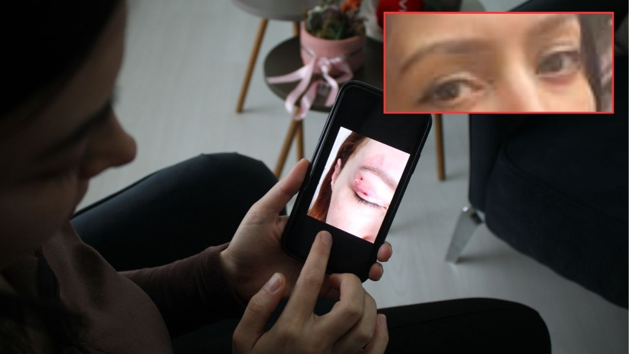 Bin yüz liralık güzellik kabusu! Gözü kapanmıyor, onarımı ise 150 bin lira