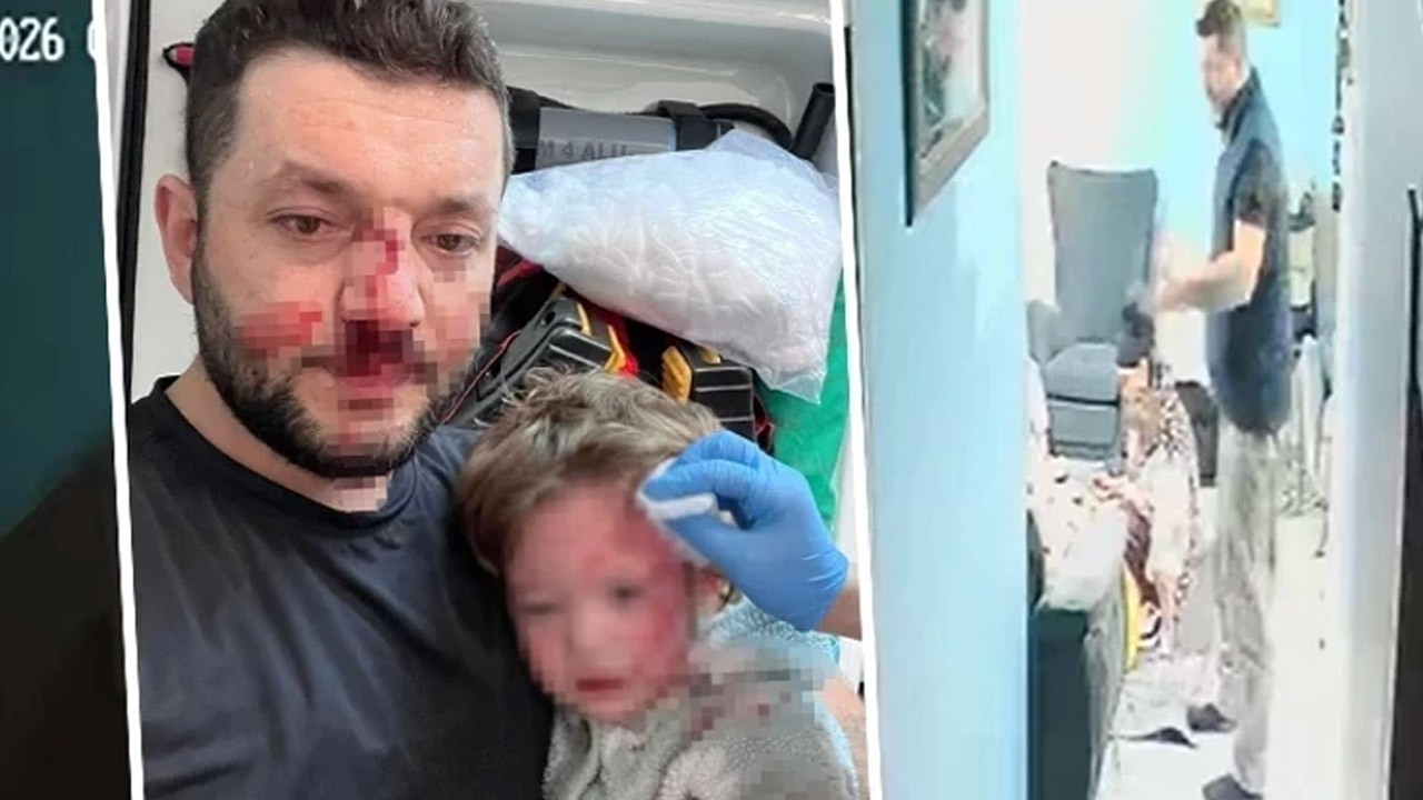 Yalova'da baba ve kızına scooterlı saldırıda iddianame hazır!