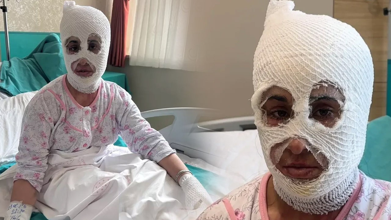 İftar vakti feci kaza: “Yüzüme elimi sürdüm, et parçası geliyordu”