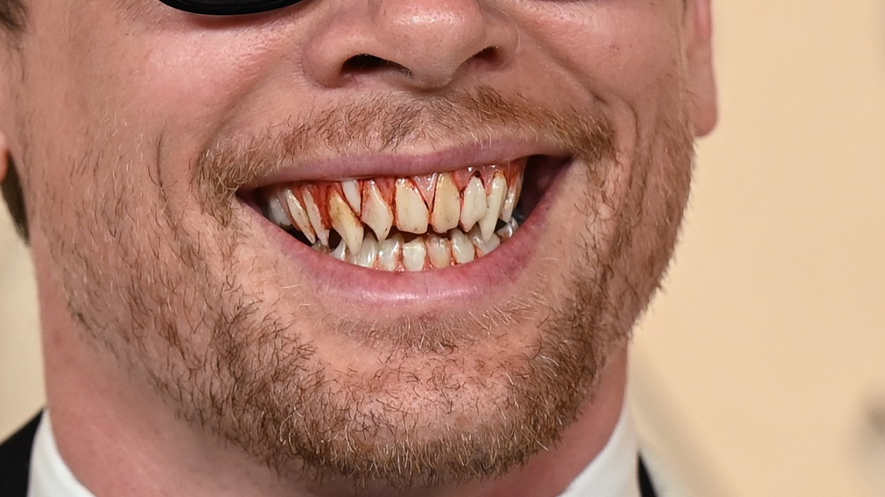 Oscar Kırmızı halısında şok detay: Dişlerini gören bir daha baktı