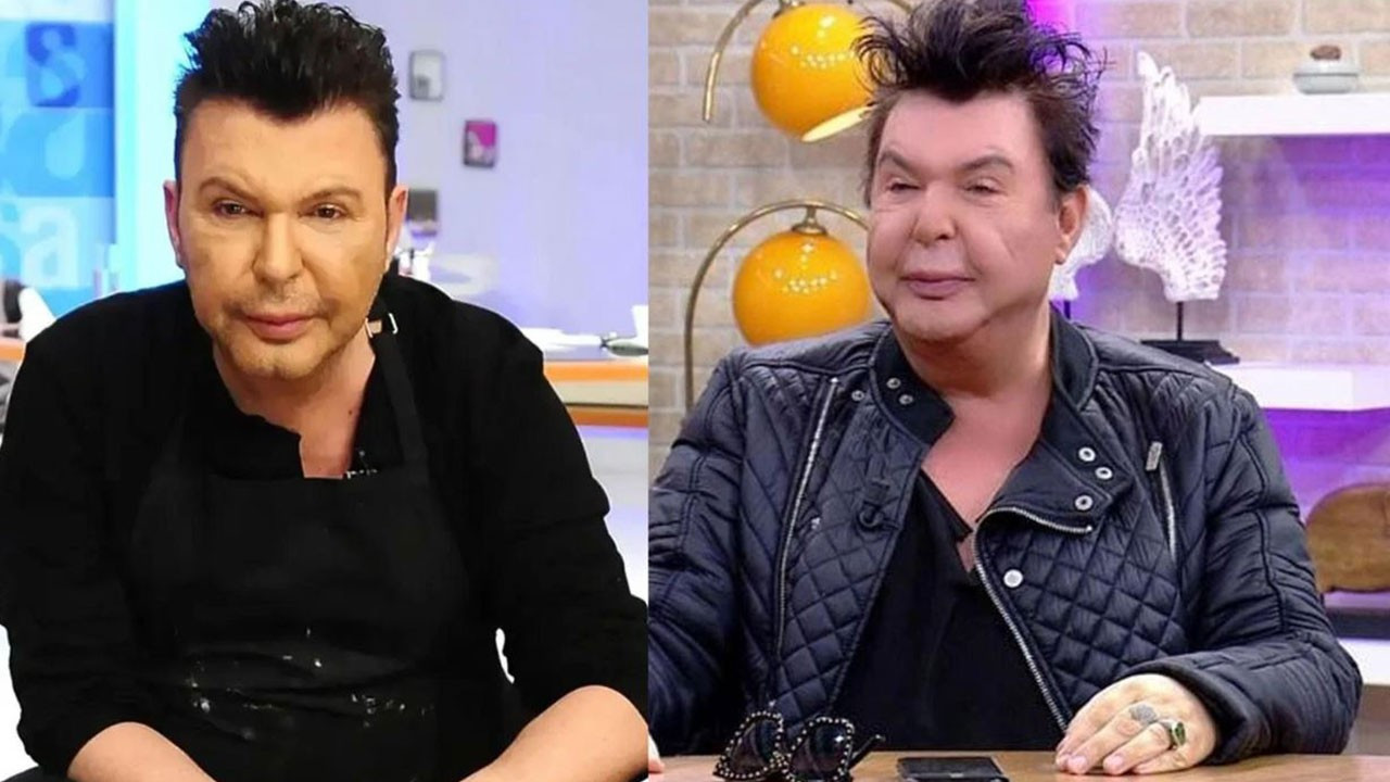 Estetik dolgular kabusu olmuştu! Kuşum Aydın yüz gerdirme operasyonu geçirdi, son halini görenler büyük şaşkınlık yaşadı