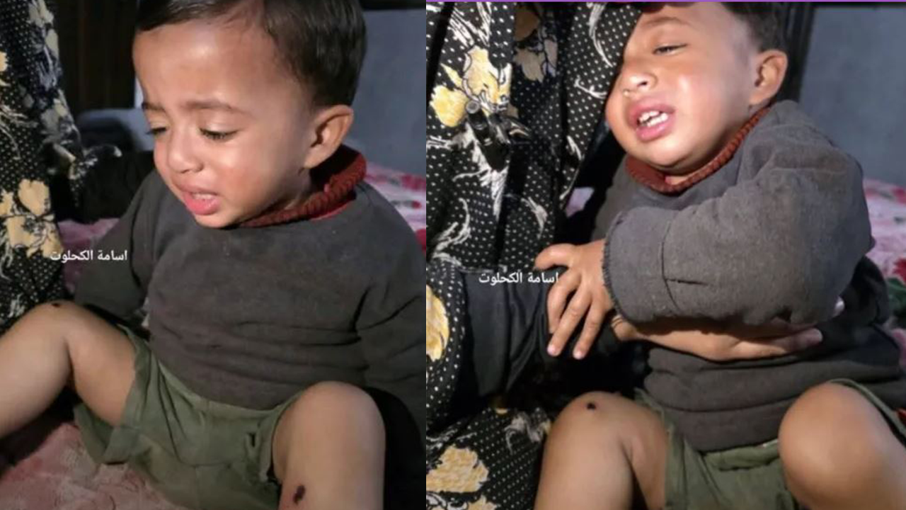 İsrail zulmü sınır tanımıyor! Sigara yanıklarıyla 1 yaşındaki bebeğe korkunç işkence: Babasına vahşeti zorla izlettiler!