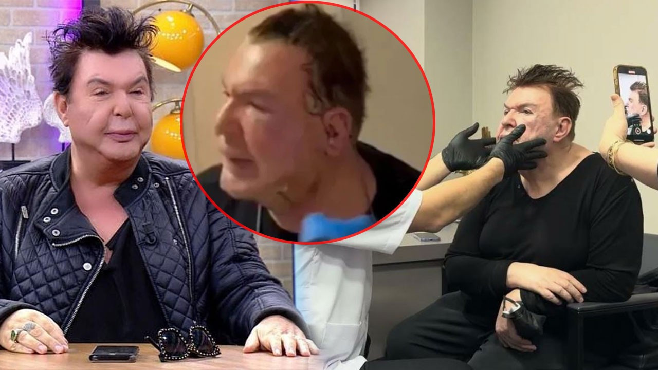 Yüz gerdirme ameliyatı olmuştu! Kuşum Aydın son ha…