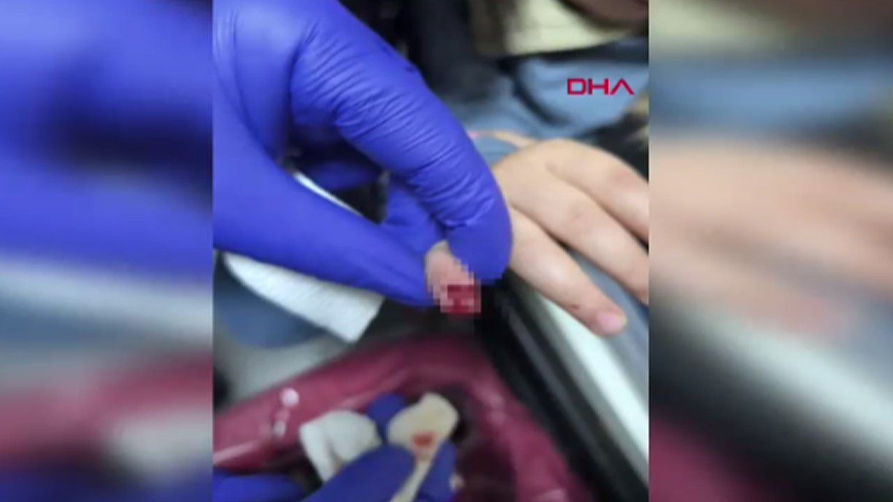 AVM'de korkunç olay! Yürüyen merdivene eli sıkışan çocuğun parmağı koptu