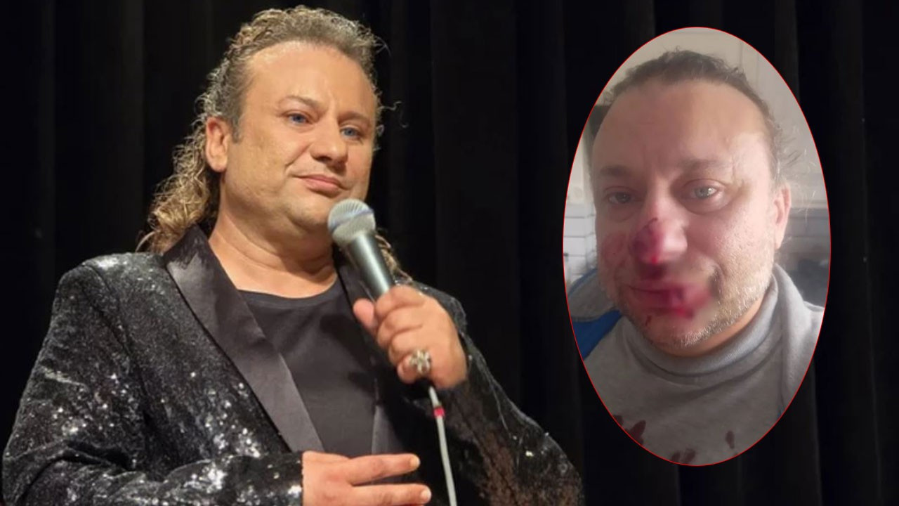 Onur Akay dehşeti yaşadı! Pitbull saldırısına uğradı, burnu koptu