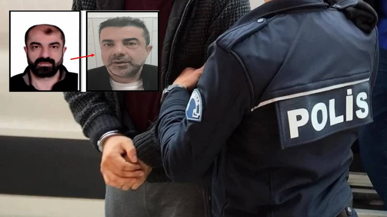 Cinayetten kaçmak için estetikle yüzünü değiştirdi! 7 yıl sonra yakalandı