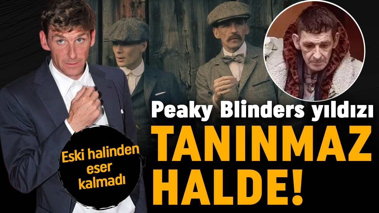 Peaky Blinders yıldızı tanınmaz halde! Eski halinden eser kalmadı