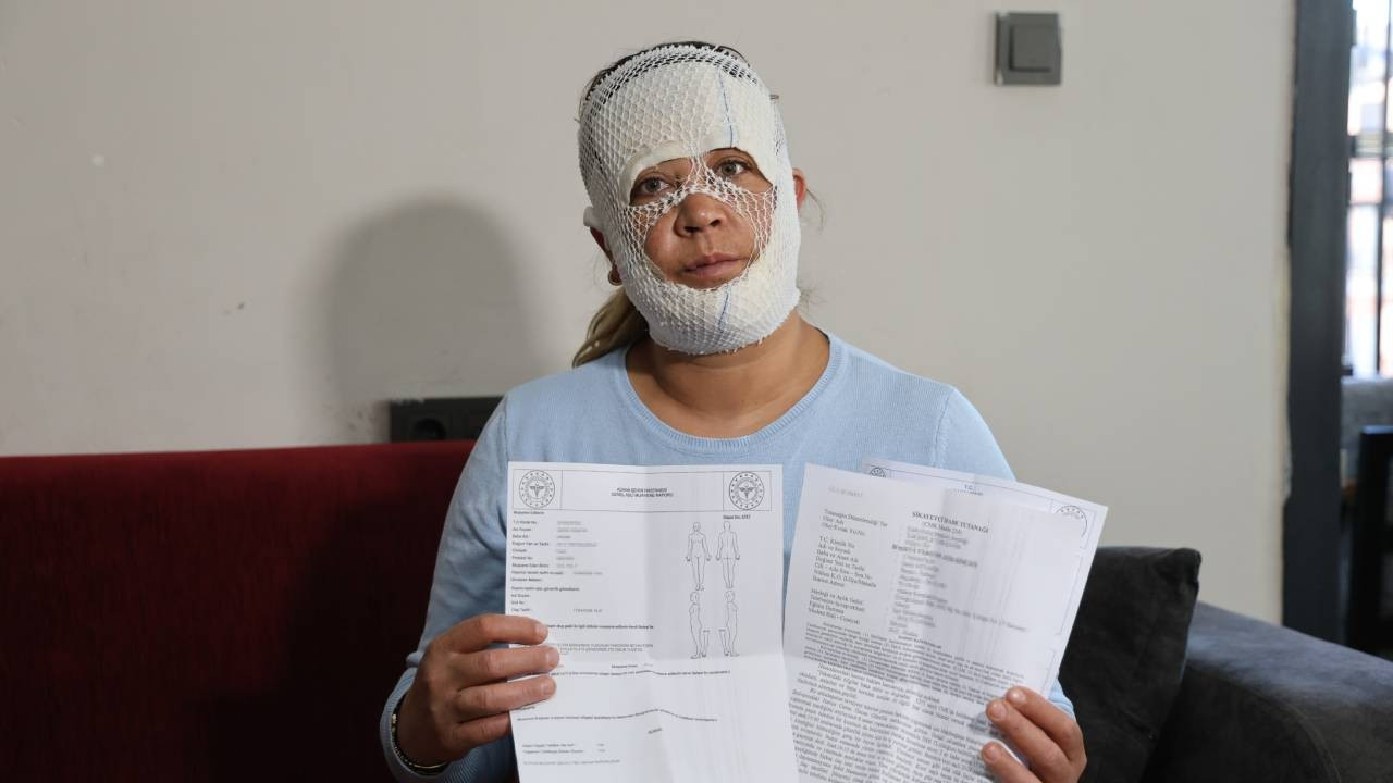 7 bin TL verdiği ‘Prenses cilt bakımı’ kabusu oldu! Yüzünü yakıp, dalga geçtiler