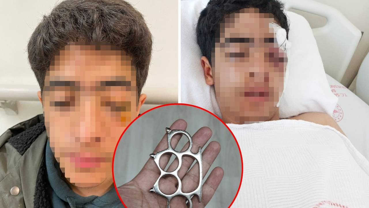 Esenyurt’ta akran zorbalığı dehşeti! "Bana şaka yapma" deyince muştalı saldırıya uğradı