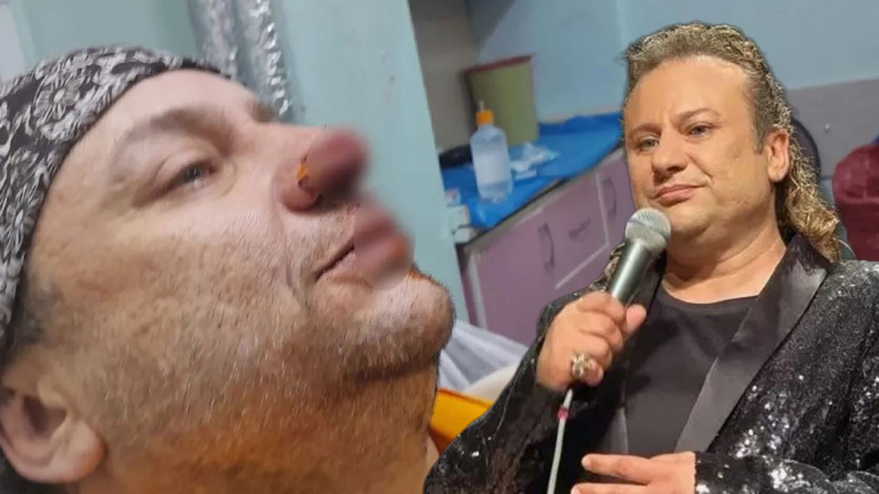 Pitbull saldırısına uğrayan Onur Akay entübe edilmişti! Ölümden dönen Onur Akay'dan haber