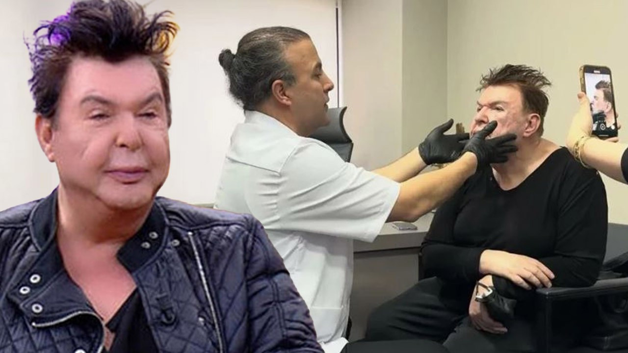 Yüz gerdirme operasyonu geçirmişti! Kuşum Aydın son halini paylaştı