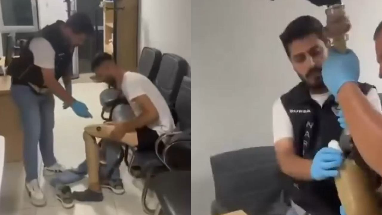 Protez bacağından çıkanlar hayrete düşürdü!