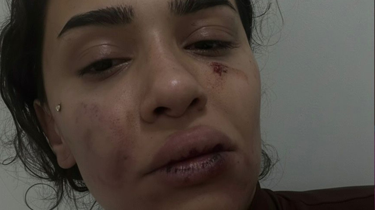 Eski sevgiliden öldüresiye darp! Hemşire Ebru’nun yardım çığlığı: Ölmek istemiyorum