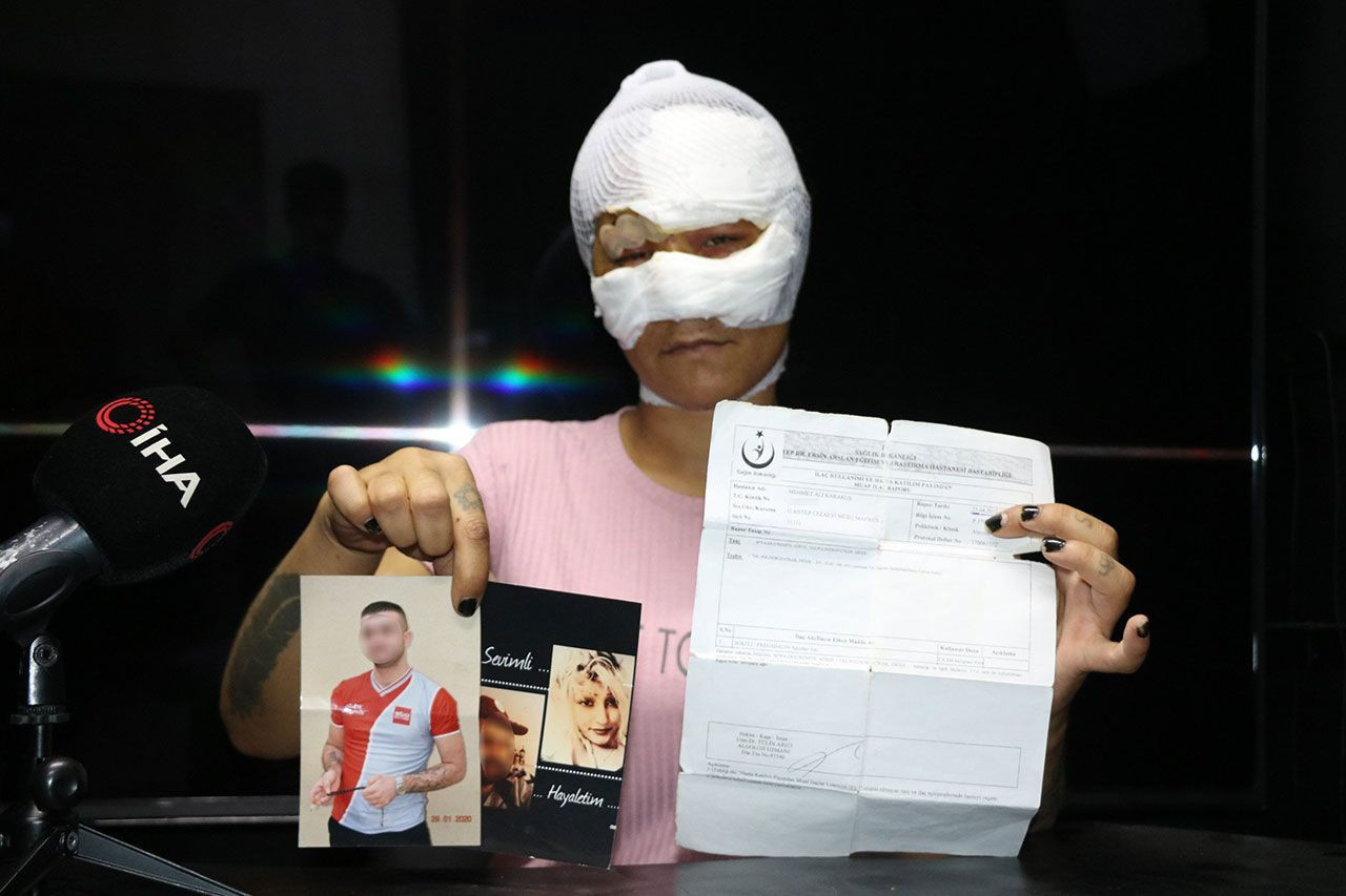 Dilber Argın, 7 saat işkenceye maruz kaldı, tecavüze uğradı - Resim: 1
