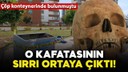 Çöpte bulunan kafatasının sırrı çözüldü!