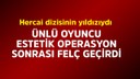 Ünlü oyuncunun estetiği faciaya dönüştü