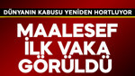 Dünyanın kabusu yeniden hortluyor! Maalesef ilk vaka görüldü