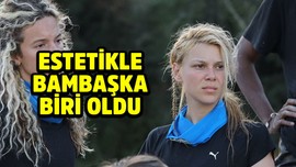 Survivor Sancakay'ın son hali akılları aldı! Estetikle bambaşka biri oldu!