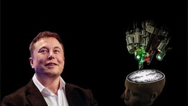 Elon Musk'ın beyin çipi onay aldı! Gönüllü insan denekler aranıyor