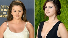 Aldığı kilolarla gündeydi! Selena Gomez'in son hali şoke etti! Resmen eridi bitti, eski halinden eser yok