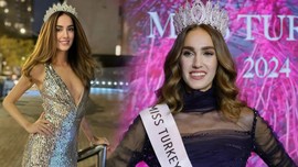 "Çirkin" diye eleştirilmişti! Miss Turkey birincisi İdil Bilgen'den güzellik standartlarına eleştiri geldi! "Kadınlar üzerinde baskı oluşturuyor"