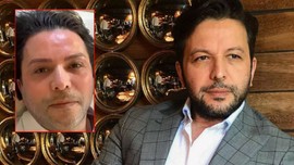 Değişimiyle gündem olmuştu! Nihat Doğan neden estetik yaptırdığı açıkladı!