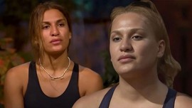 Survivor'dan diskalifiye edilen Almeda Baylan burun estetiği oldu! Operasyon sonrası ilk görüntüsü ortaya çıktı