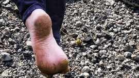 Erzincan'da doğada yürüyüş yapan vatandaşın karşısına çıktı. Bölgede 1 kez görülüyordu, vatandaş 2 tarafınca bakınca gördüğü detayla resmen dehşete düştü