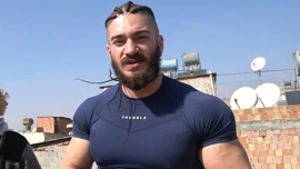 Ünlü YouTuber Testo Taylan'ı köpek ısırdı! Sağlık durumunu açıkladı